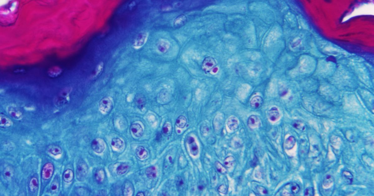 Zoonosis: la clave detrás de las últimas alertas sanitarias