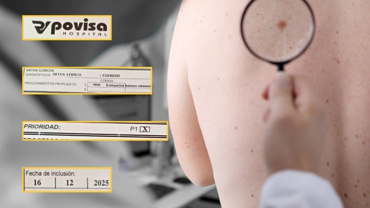 Una intervención cirúrgica que según los criterios publicados por el Sergas tenía que resolverse en un máximo de 30 días, lleva 50 días esperando en Povisa.