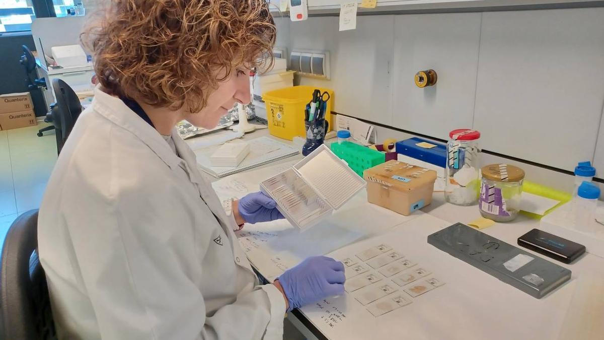 Un grupo de científicos españoles identifica la célula que origina el Sarcoma de Ewing