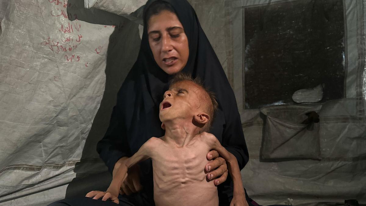 Los muertos por desnutrición en Gaza superan los 200, casi la mitad niños