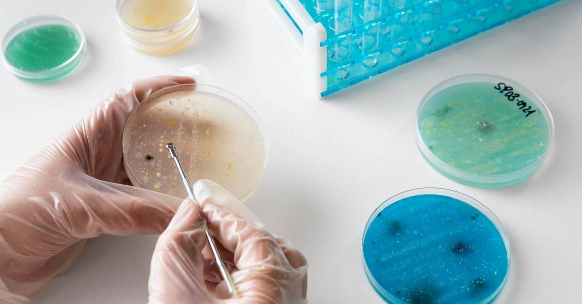 La Exposición a Colibactina en la Infancia Relacionada con el Aumento del Cáncer Colorrectal en Jóvenes