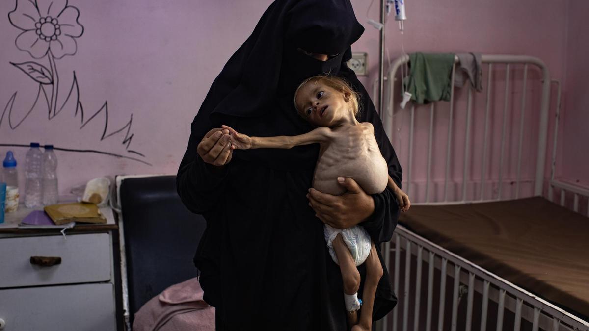 Palestiinian child Sham Qudeih amid spreading famine in Gaza